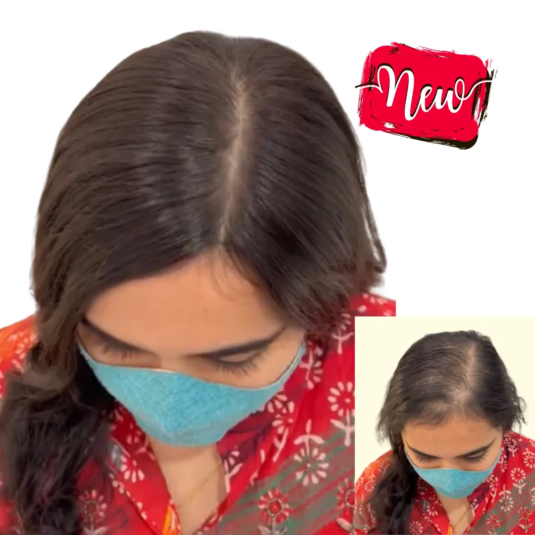 InstaHair LightTop Light Volume Hair Topper for Women