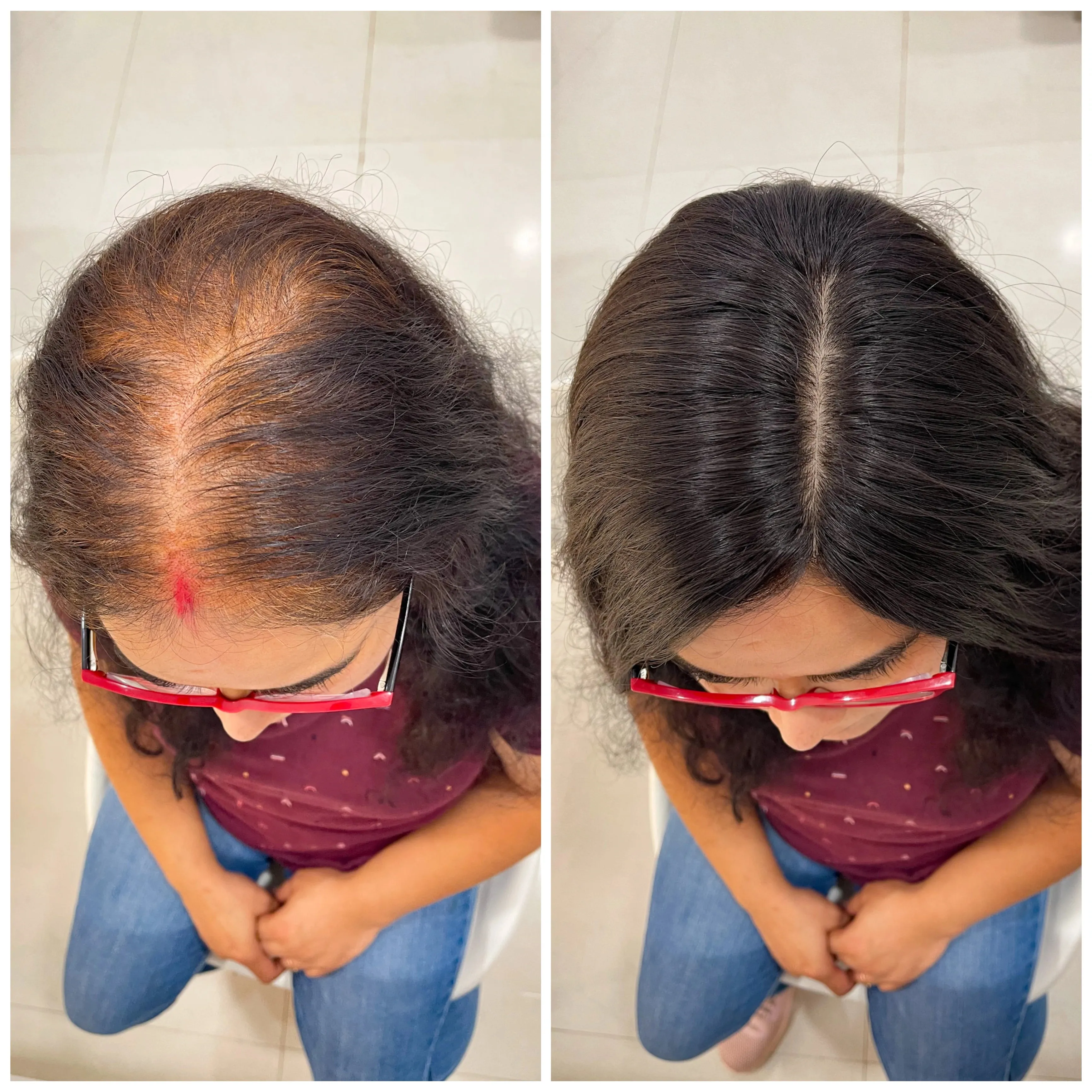 InstaHair LightTop Light Volume Hair Topper for Women